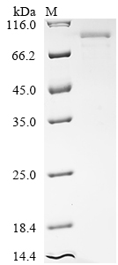 SDS-PAGE
