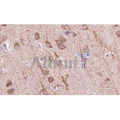 Валидация Affinity DF2706 - 13420