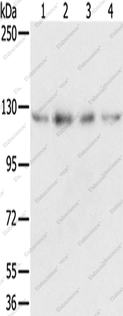 Вестерн-блоттинг, RBM5, клетки Huvec, HepG2, 293T и A549
