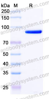 EHK26803, SDS-PAGE