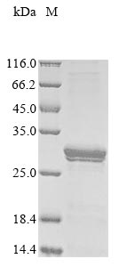SDS-PAGE