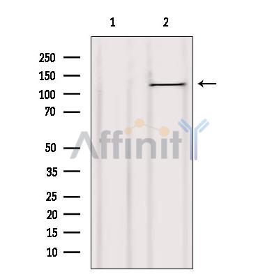Валидация Affinity AF6225 - 3463