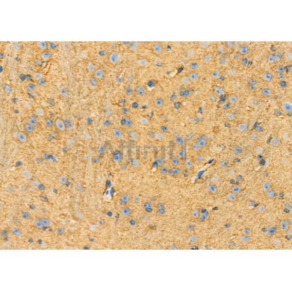 Валидация Affinity DF12418 - 6920