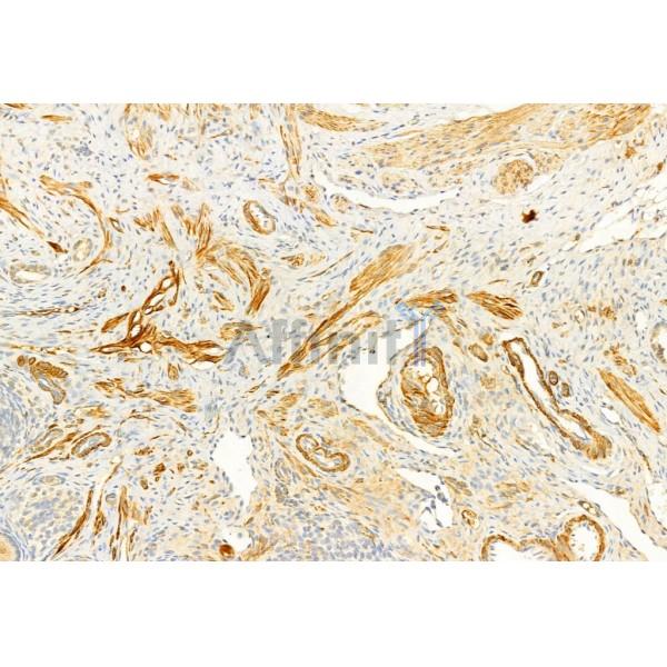 Валидация Affinity AF7007 - 4142