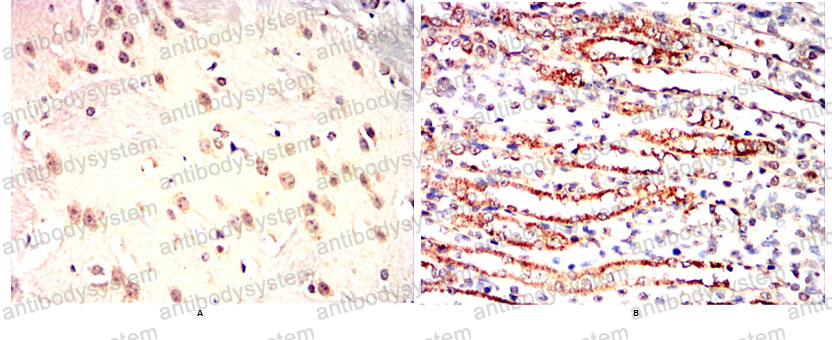 Валидация AntibodySystem RHD75202 (1803)