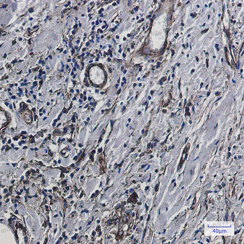 Валидация AntibodySystem RHF88101