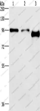 Вестерн-блоттинг, PIP5K1C, клетки A431 и HeLa, ткань мозга мыши