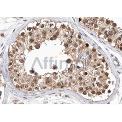 Валидация Affinity AF5234 - 2715