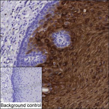 Валидация AntibodySystem RHK92501