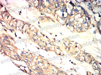 Валидация AntibodySystem RHE77502 (2315)