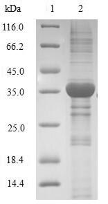 SDS-PAGE