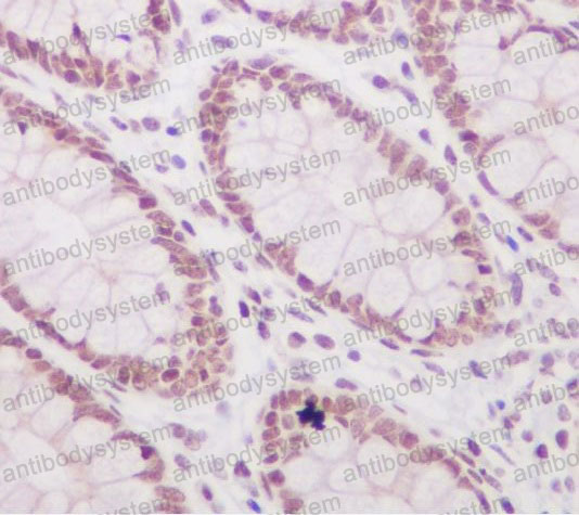 Валидация AntibodySystem RHF62715 (2620)