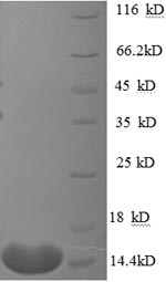 SDS-PAGE