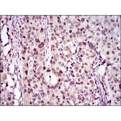 Валидация Affinity BF0704 - 5376