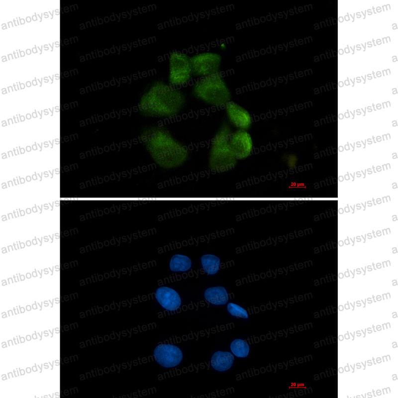 Валидация IF - AntibodySystem RHK43801