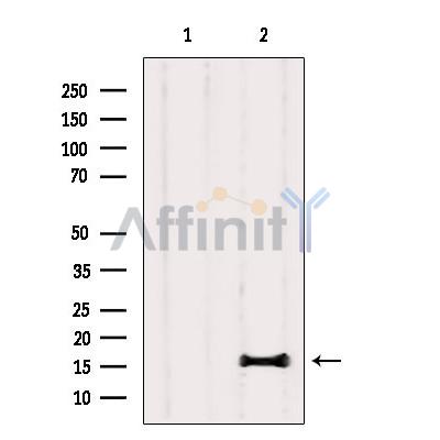 Валидация Affinity DF8208 - 20046