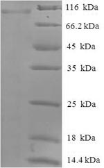 SDS-PAGE