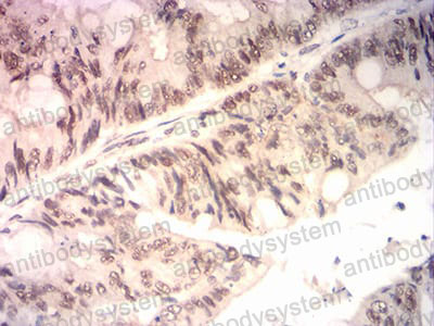 Валидация AntibodySystem RHN97702