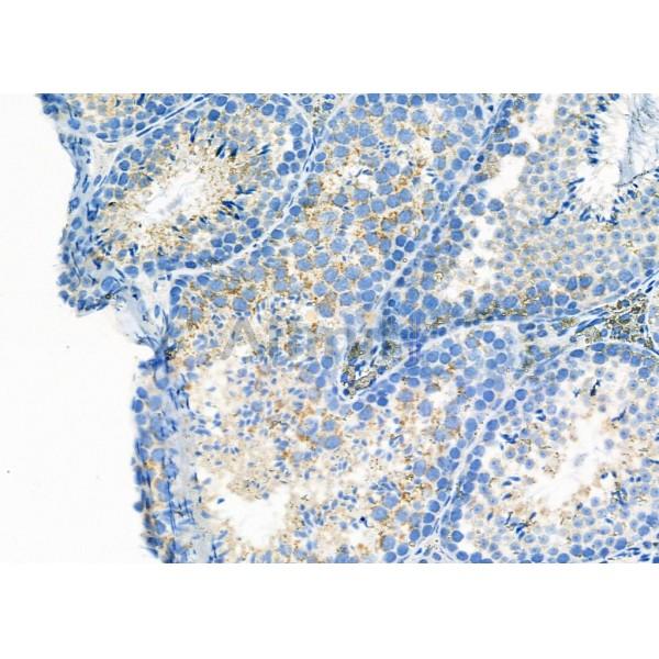 Валидация Affinity DF7292 - 18970