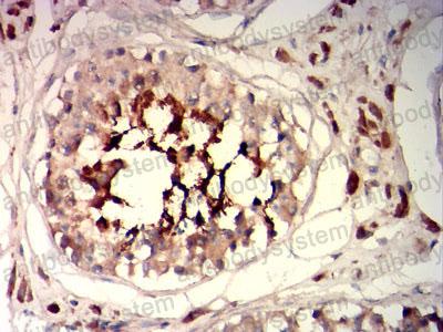 Валидация AntibodySystem RHH11502