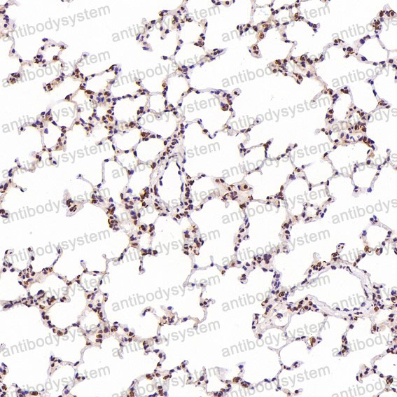 Валидация AntibodySystem RHJ51602 (3444)