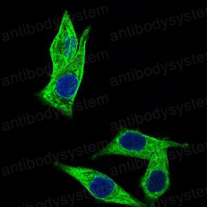 Валидация IF - AntibodySystem RHP00101 (1706)