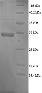 SDS-PAGE