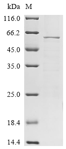 SDS-PAGE