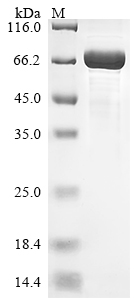 SDS-PAGE