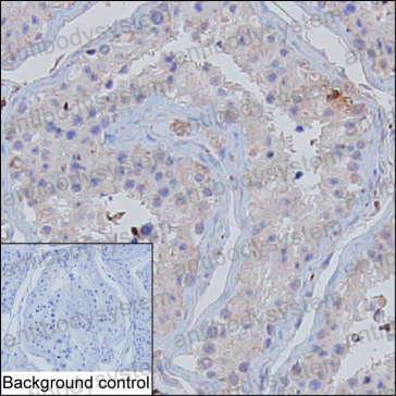 Валидация AntibodySystem RHE94803