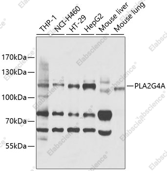 Вестерн-блоттинг, PLA2G4A, различные клеточные линии