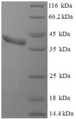 SDS-PAGE