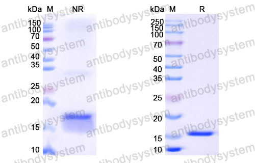 Валидация SDS-PAGE - AntibodySystem RHB86903