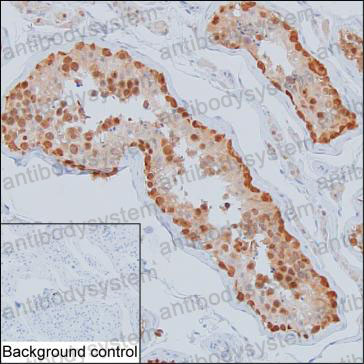 Валидация AntibodySystem RHJ84903