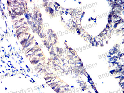 Валидация AntibodySystem RHE14901