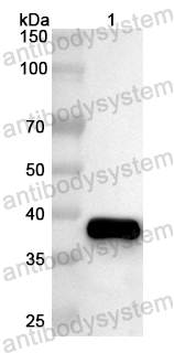 Валидация AntibodySystem PHB03601