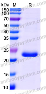 AHD85401, SDS-PAGE
