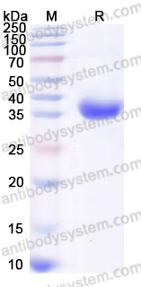 EHG05901, SDS-PAGE