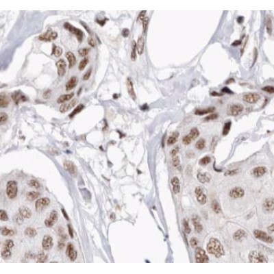 Валидация Affinity DF6386 - 17746