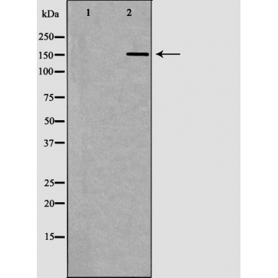 Валидация Affinity DF6165 - 17405