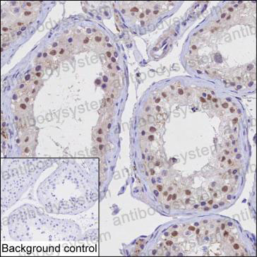 Валидация AntibodySystem RHE91501