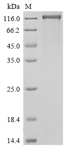 SDS-PAGE