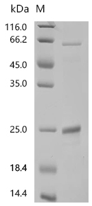 SDS-PAGE