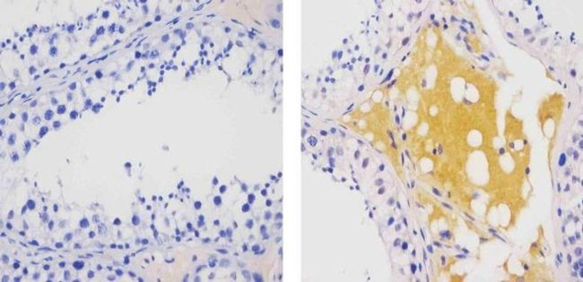 Валидация AssayVector ARM1577(1616)