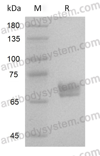 AHF18601, SDS-PAGE