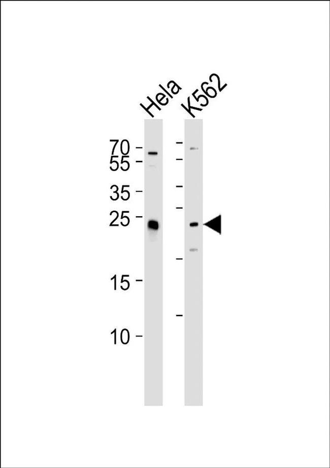 Валидация AssayVector ARM2785(5484)