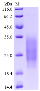 SDS-PAGE