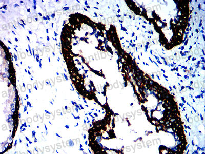 Валидация AntibodySystem RHD31601