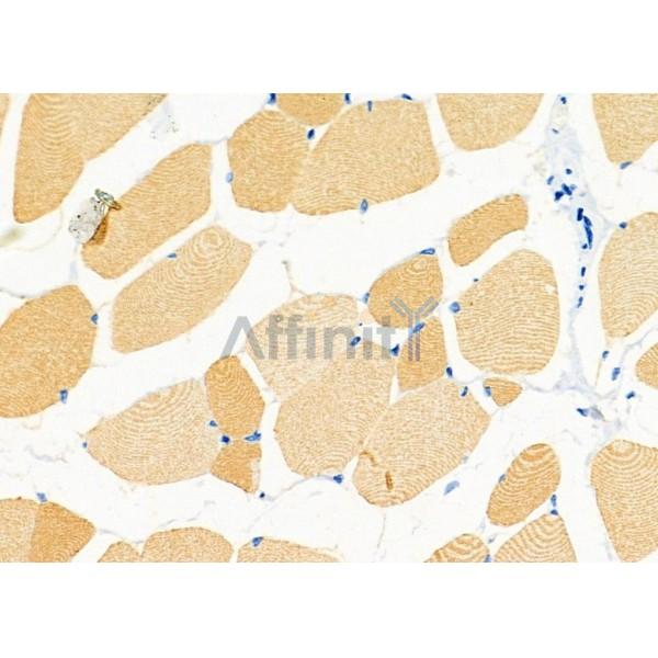 Валидация Affinity DF7162 - 18811