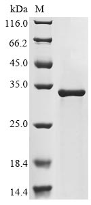 SDS-PAGE